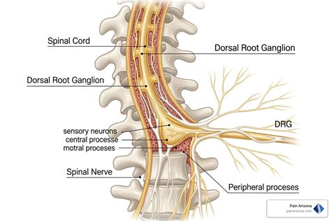 dorsal root ganglion breakthrough  pain relief