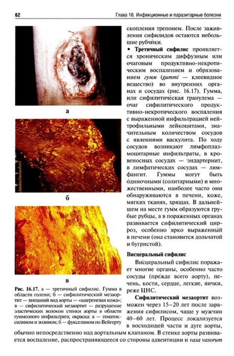 В.С. Пауков ПАТОЛОГИЧЕСКАЯ АНАТОМИЯ Том 2. Частная патология Учебник ...