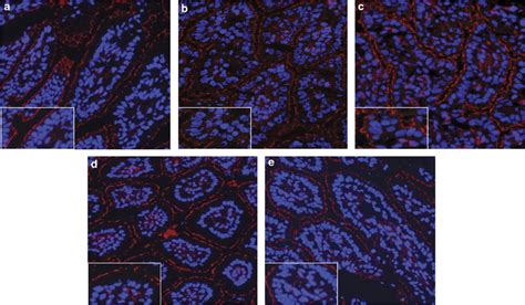 Localization Of The Tight Junctional Protein Zo 1 A Zo 1 Staining Download Scientific