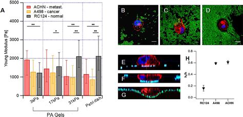 Atomic Force Microscopy For Cell Mechanics And Diseases