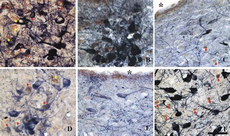 Fos Brown And Nadph D Blue Black Double Labeling In The