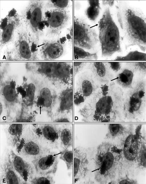 Localized Adherence Patterns In HeLa Cells Of Representative Atypical