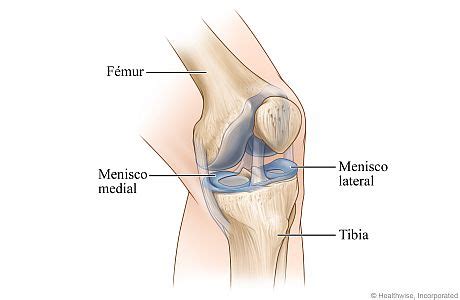 Meniscos De La Articulaci N De La Rodilla Cigna