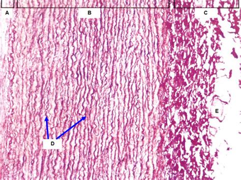 Histology Lab Cardiac Muscle And Vessels Flashcards Quizlet