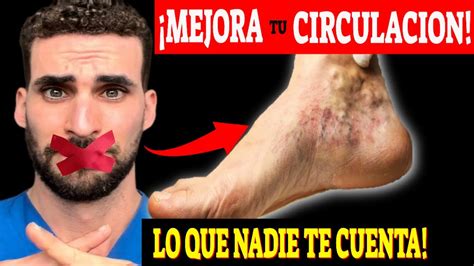 Cura La Mala Circulaci N Sin Remedios Youtube