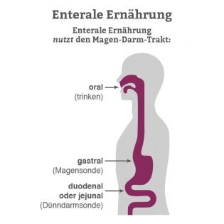 Enterale Ern Hrung Definition Sonde Arten Technik