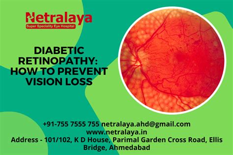 Diabetic Retinopathy How To Prevent Vision Loss Netralaya