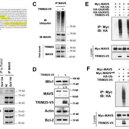 The E3 Ubiquitin Ligase TRIM25 Catalyzes Lys 48 Linked Ubiquitination