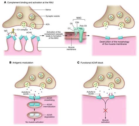 Pathophysiology Of Myasthenia Gravis Schematic Diagram