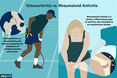 Ursachen Und Risikofaktoren Von Arthrose Medde