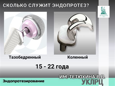 Сколько служит эндопротез? - Бесплатное лечение по ОМС