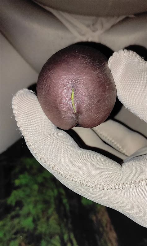 Super Glue In Penis Pee Hole Nude Pics Xhamster