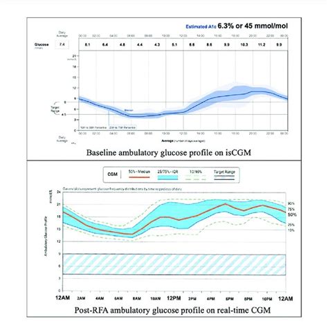 Baseline And Post RFA Ambulatory Glucose Profile IsCGM