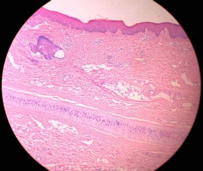 Ear Histology - External ear, monkey - histology slide