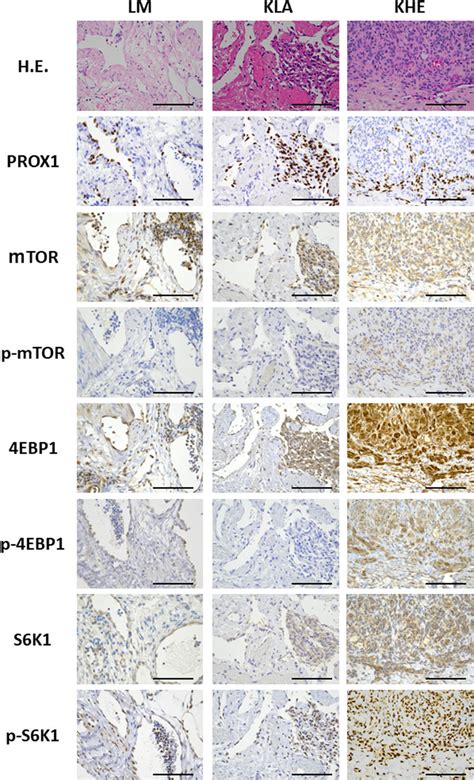 Representative Immunohistochemical Staining Patterns In Various