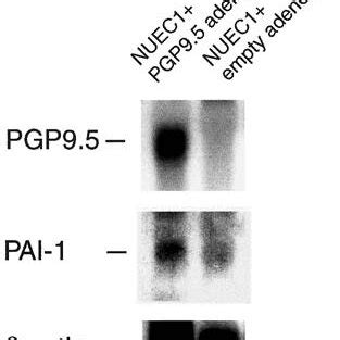 Detection Of PGP9 5 And PAI 1 Expression By Northern Analysis In