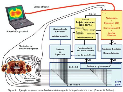 Tomografía de impedancia eléctrica en la lesión pulmonar aguda