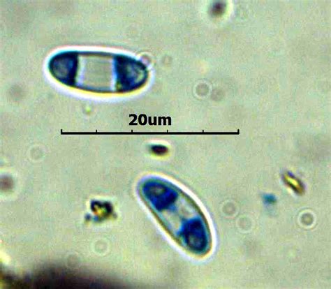 Caloplaca suaedae spores colorées au bleu de méthyle x 1000 Th