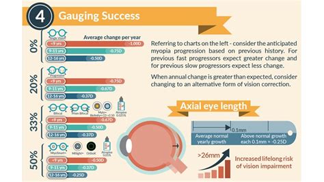 How To Gauge Success In Myopia Management Myopia