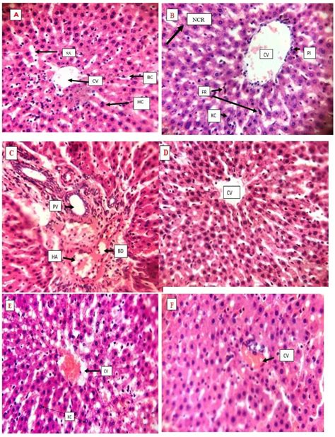 Representative Photomicrographs Of Liver Tissues Sections 400 In