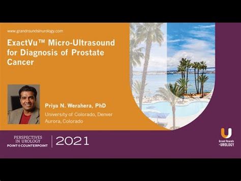 Accuracy Of Exactvu Micro Ultrasound For Diagnosis Of Prostate Cancer