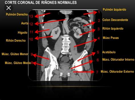 Pin By Liznel Feliberty On Imagenes De Ct Scan Y Mri Ct Scan Movie