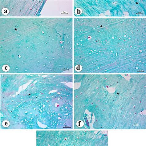 Masson Trichrome × 400 A Photomicrograph Of A Section In The Download Scientific Diagram