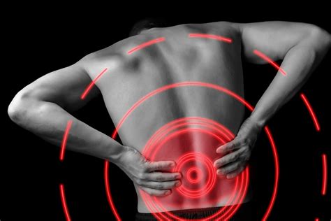 With steroid shots, back pain relief is only temporary, at best, study