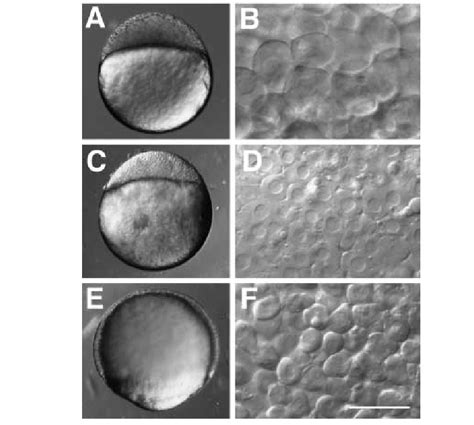 Alpha Amanitin Treated Embryos Do Not Initiate Epiboly A Untreated