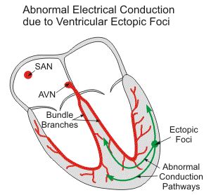 Cv Physiology Ectopic Foci