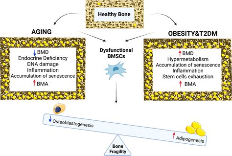 Frontiers The Pathophysiology Of Osteoporosis In Obesity And Type 2