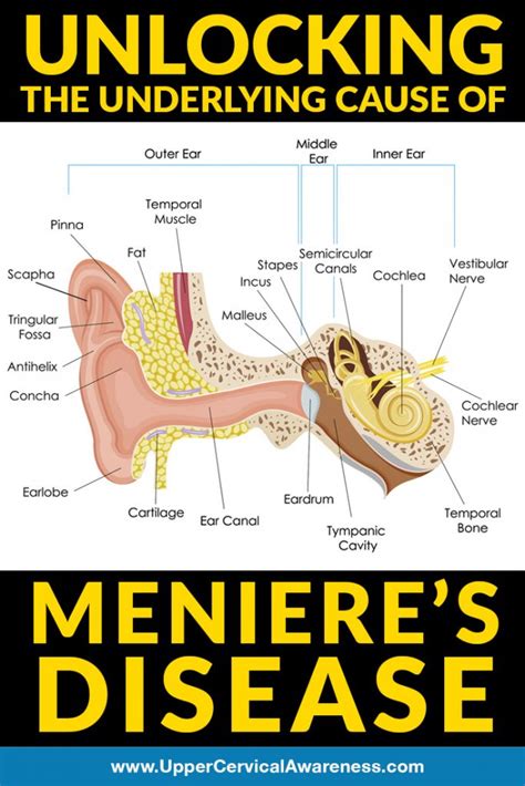 Meniere S Disease Caused Paul Smith