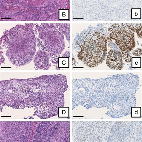 List Of Three Histological Types Of Malignant Neoplasm In Six Organs