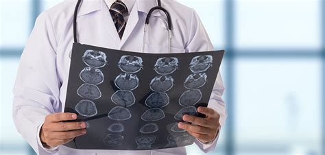 Conditions Treated By an Expert Neurologist - Radar MedicalRadar Medical 