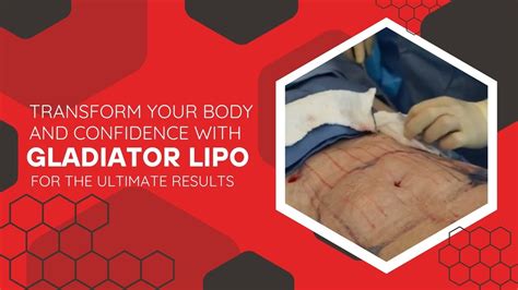 TRANSFORM YOUR BODY AND CONFIDENCE WITH GLADIATOR LIPO FOR THE ULTIMATE