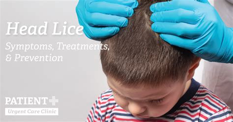 Head Lice: Symptoms, Treatments, and Prevention | Patient Plus