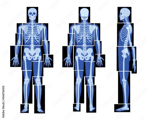 Set Of X Ray Skeleton Human Body Parts Hands Legs Chest Head