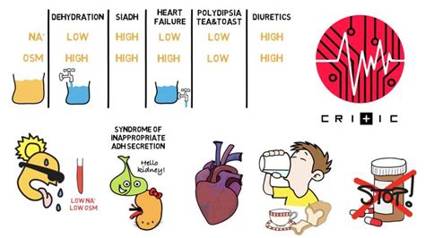 Hyponatremia Symptoms