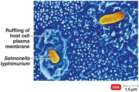 CH 15 Microbial Pathogenesis PART 2 Flashcards Quizlet