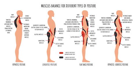 Comparison of muscle imbalance in various postural disorders. Kyphotic ...