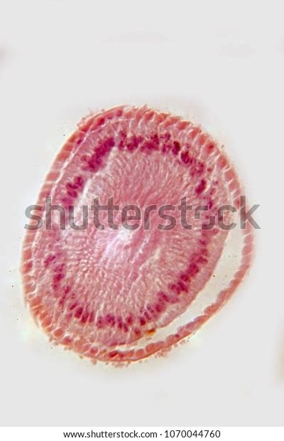 Human Worm Under Microscope Stock Photo 1070044760 | Shutterstock