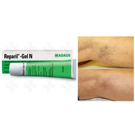 REPARIL-GEL N เจลทารอยฟกช้ำ ขนาด 20 กรัม