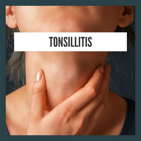 Tonsillitis symptoms and natural treatment | ShittyHealth