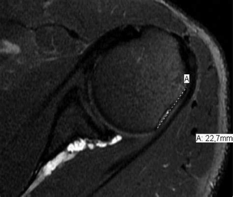 Axial Slice Of Magnetic Resonance Imaging For Evaluation Of The Download Scientific Diagram