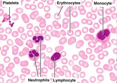 Spleen Disorders Ask Hematologist Understand Hematology