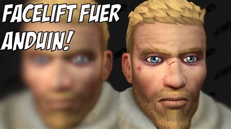 Facelift F R Anduin In The War Within Neues Model Wird Nochmal