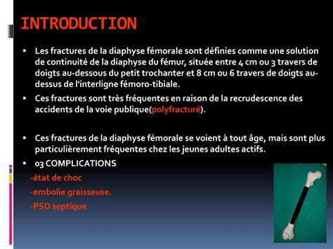 Ppt Fractures De La Diaphyse Femorale Powerpoint Presentation Free