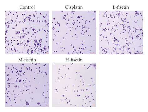 Fisetin affects tumor cell proliferation; (a) colony formation assay of ... 