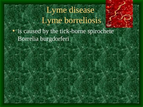 Ppt Lyme Disease Lyme Borreliosis Is Caused By The Tick Borne