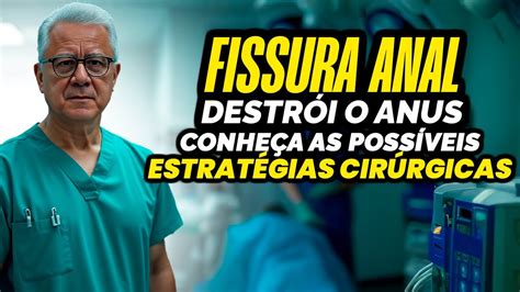 Fissura Anal Perigo DESTRUIÇÃO ANUS Soluções Cirúrgicas Vocês Precisam Conhecer YouTube